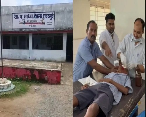 स्कूल में खूनी संघर्ष : एक छात्र ने दूसरे के चेहरे और गले पर मारा ब्लेड, स्कूल प्रबंधन रहा अनजान, घायल का इलाज जारी