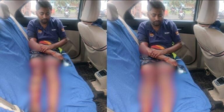 CG Crime News : चॉइस सेंटर संचालक पर चाकू से जानलेवा हमला, आरोपियों ने पुरानी रंजिश में वारदात को दिया अंजाम